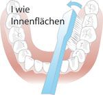 Innenflächen-Putztechnik